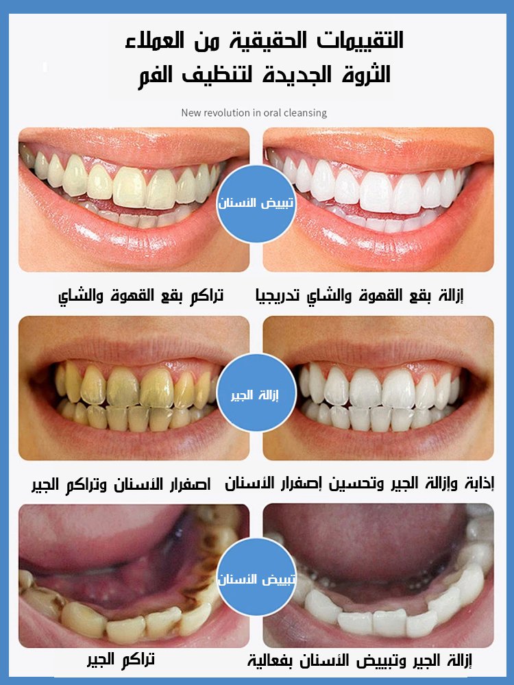 فرشاة أسنان كهربائية مبتكرة مع وظيفة تبييض الأسنان، مناسبة لجميع أفراد الأسرة استخدامها
