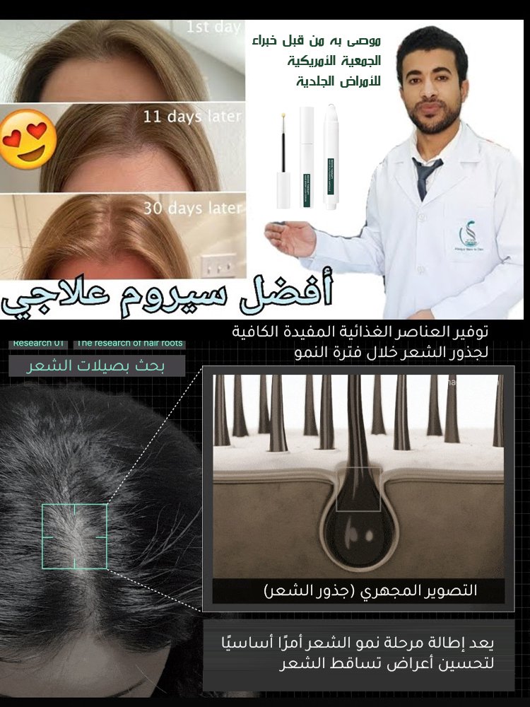 سيروم لتقوية الشعر والرموش