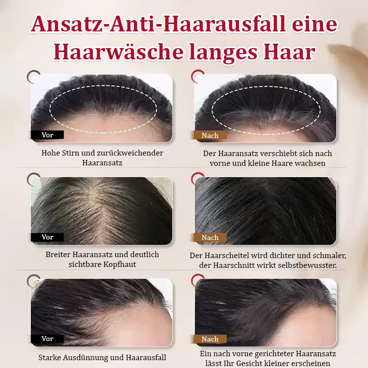 Ingwer-Haarfestigungs- und Haarwuchs-Shampoo