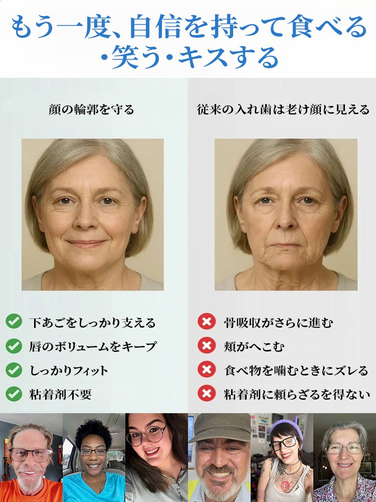 【ドイツVDDI社開発】審美ホワイトニング義歯