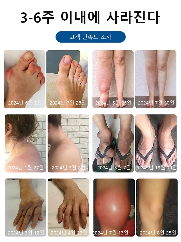 [판매량 1위】관절 연골 캡슐