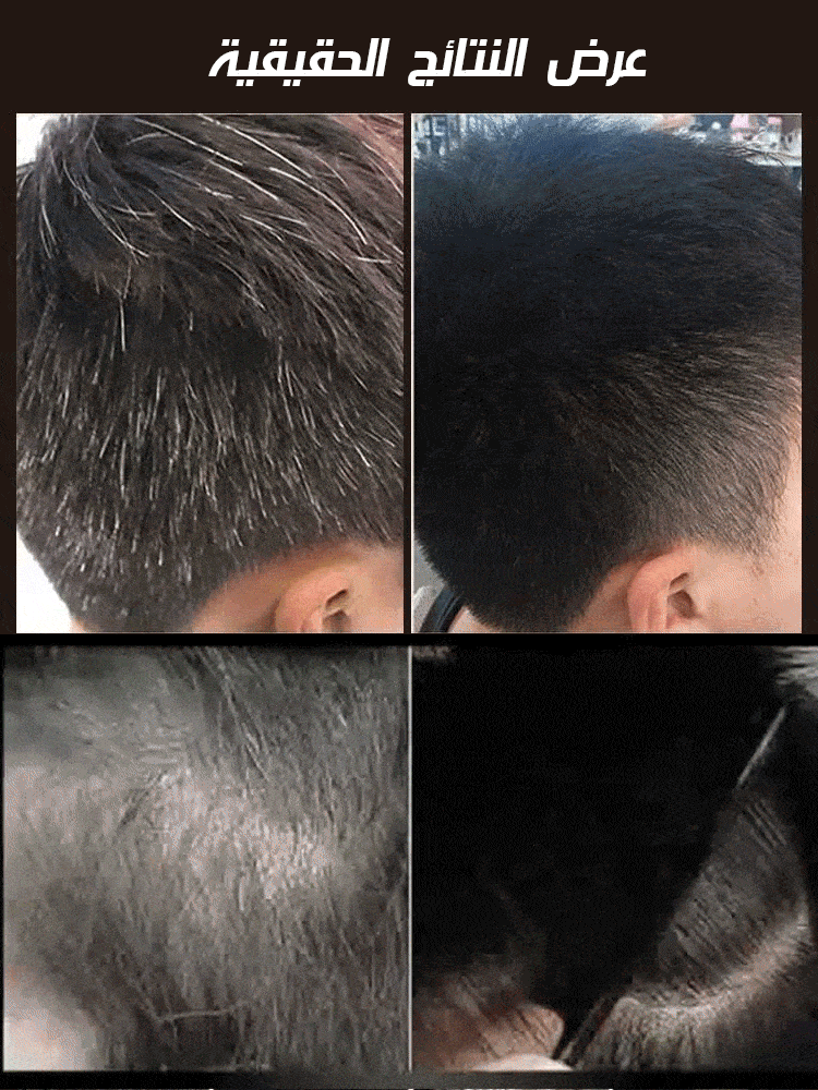 صابونة شامبو طبيعية بجانوديرما السوداء لتعزيز نمو الشعر الأسود