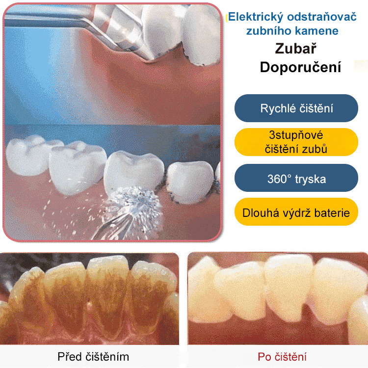 【Zlepšení zdraví zubů】Přenosná ústní sprcha