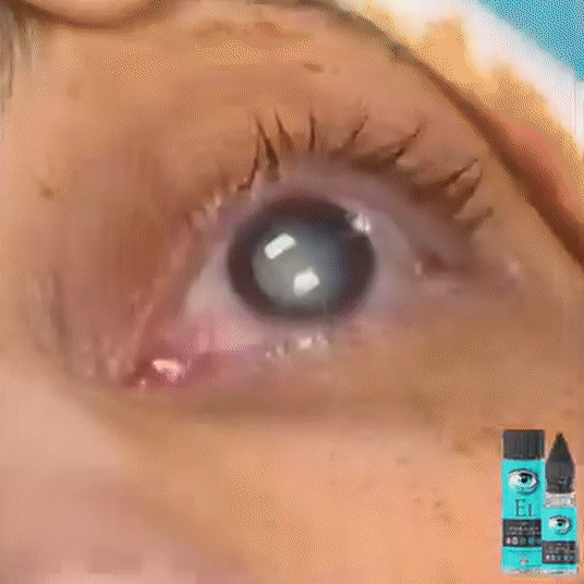 Sérum réparateur pour les yeux à la nano-vue.