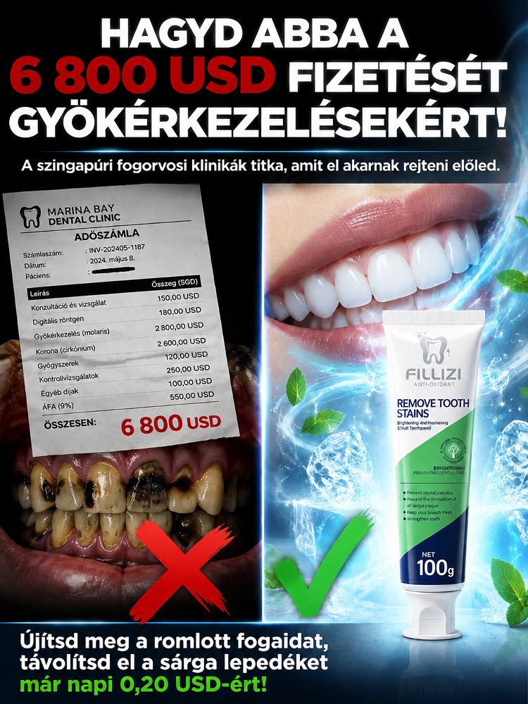 【1 másodperc alatt eltávolítja a 10 éves sárga lepedéket】Rothadt fogak újjászületése probiotikus fog