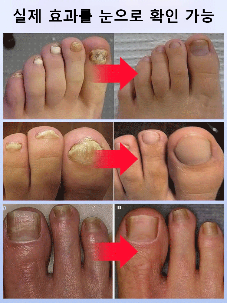 SOUTH MOON 손톱 케어 에센스