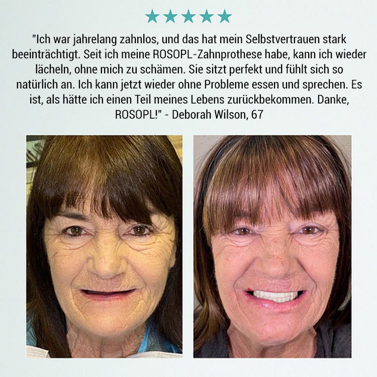 【All-Inclusive Custom】Zahnersatz Pflege- und Verschönerungsset