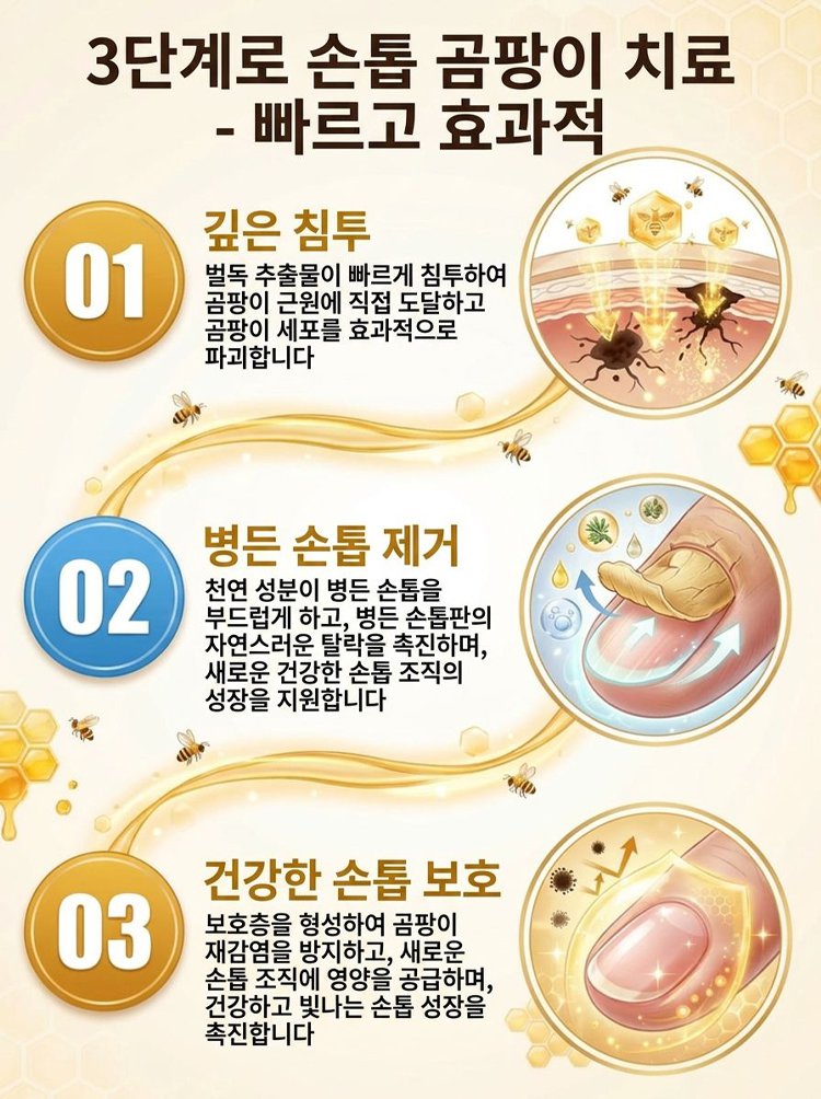 [7일 기적] 갈아낼 필요 없는 문제성 발톱 뿌리 파괴 벌독 앰플