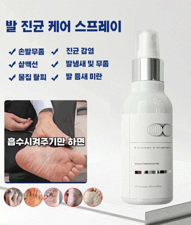 발 진균 관리 스프레이