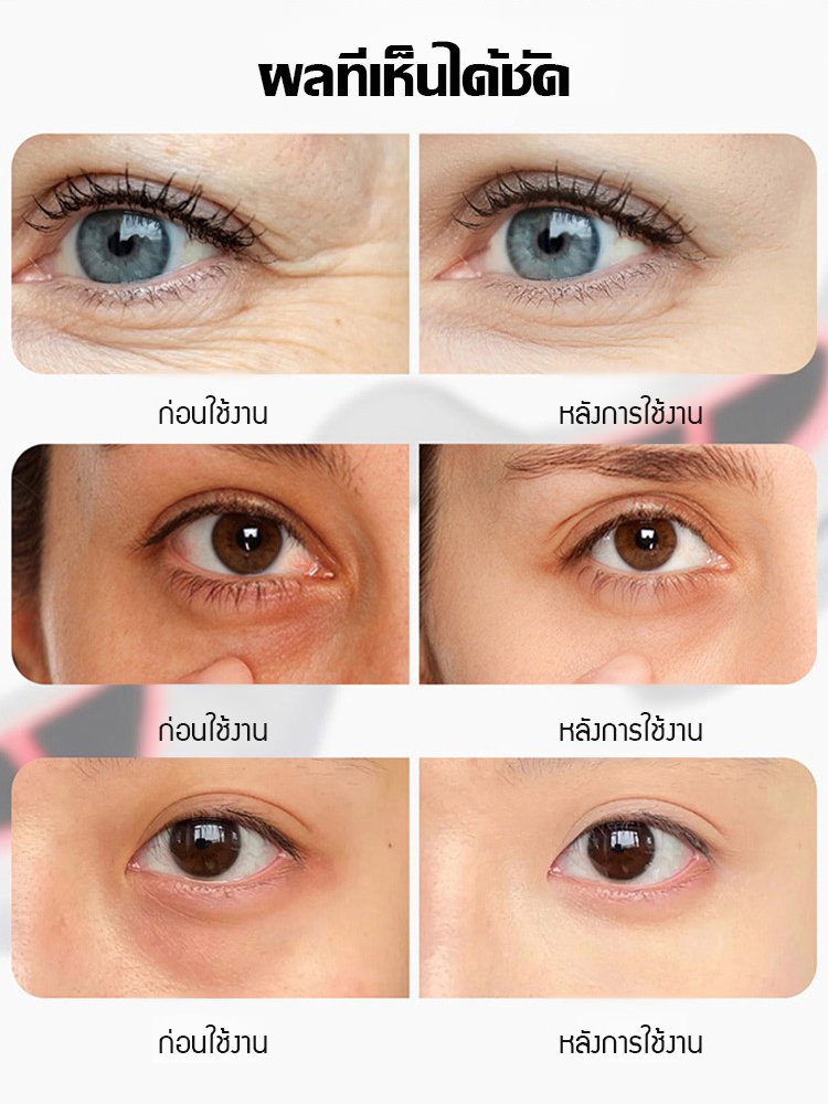 เครื่องนวดตาด้วยไมโครเคอเร้นท์