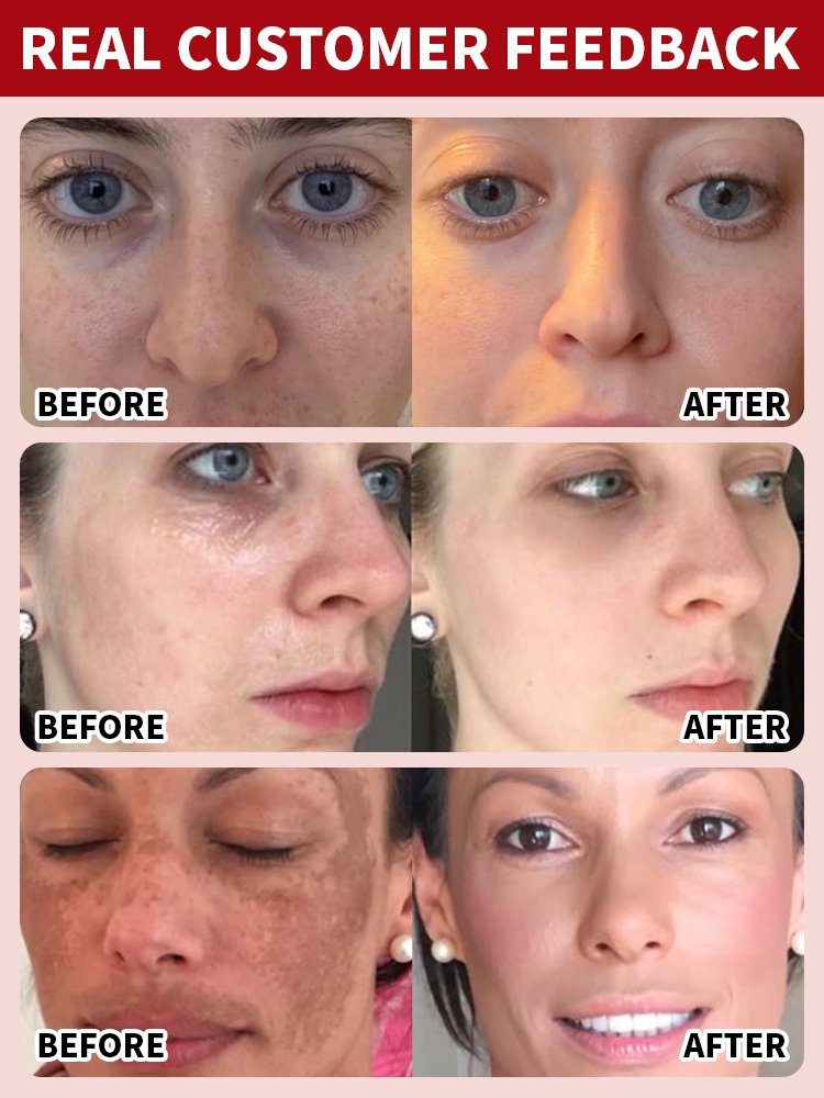 [3-in-1] Whitening, Spot-Correcting, and Anti-Wrinkle Serum