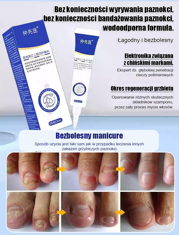 [Rozwiązanie problemu z paznokciami] Antybakteryjny krem naprawczy na grzybicę paznokci