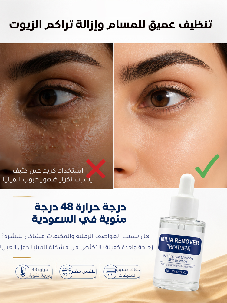 سيروم للعناية بحبوب الميليا حول العينين