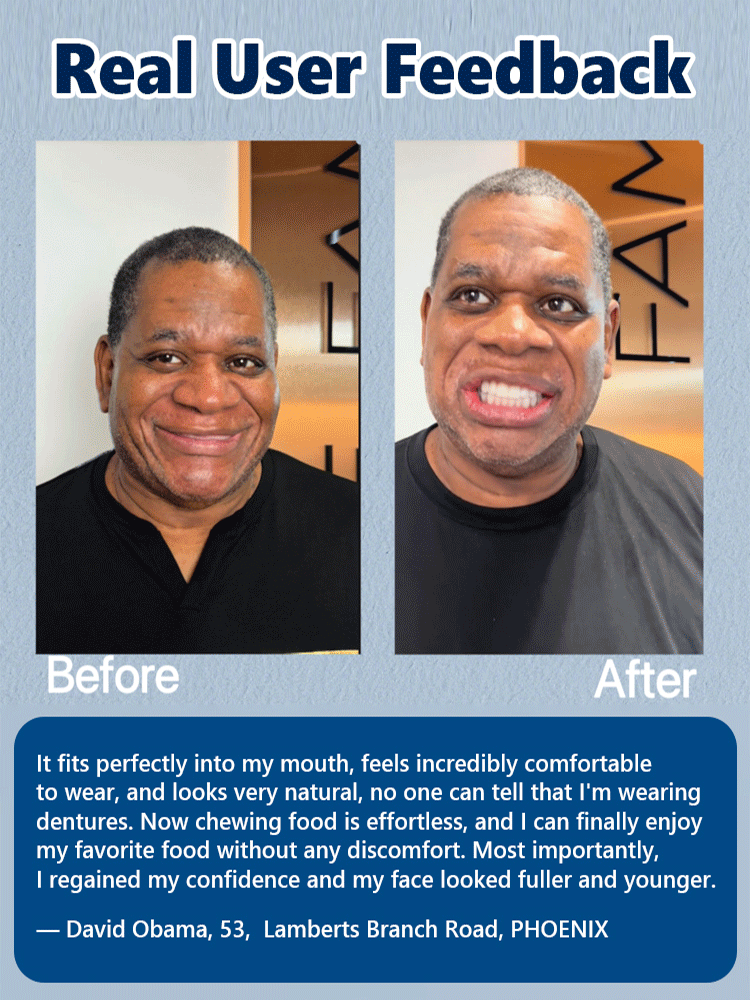 100% Realistic and Comfortable Dentures | Painless, No Glue Required丨Unisex