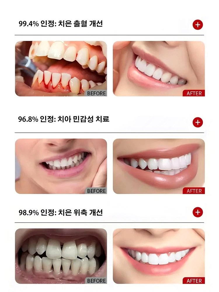 【살균율 99%】구강 유산균 스프레이