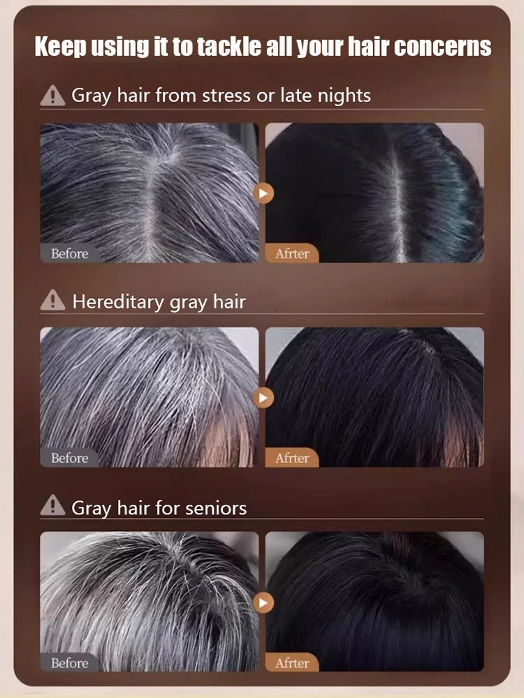 【Reversing Gray Hair】Ginseng Root and Arborvitae Leaf Shampoo