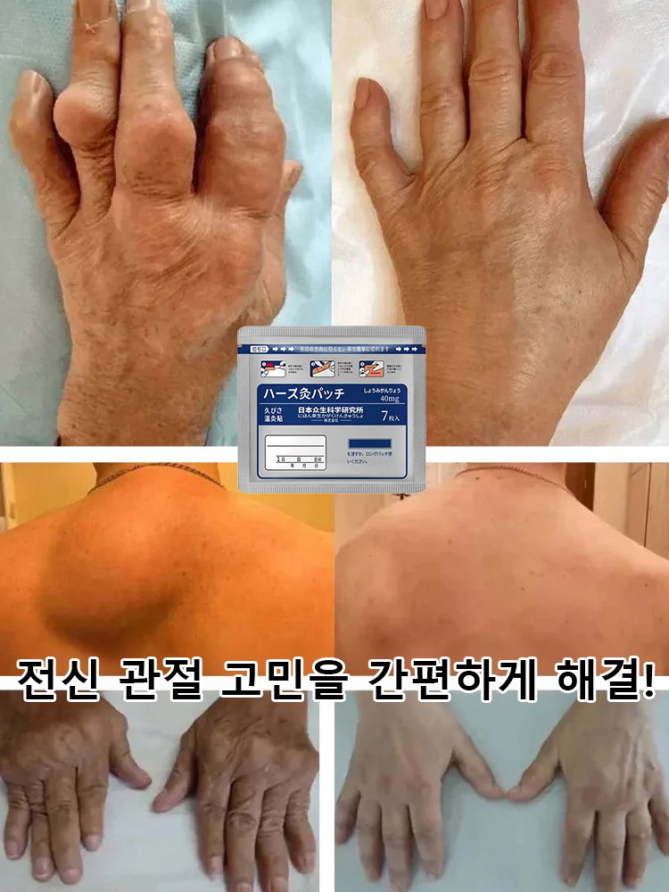 【수술 없이】투골 케어 패치