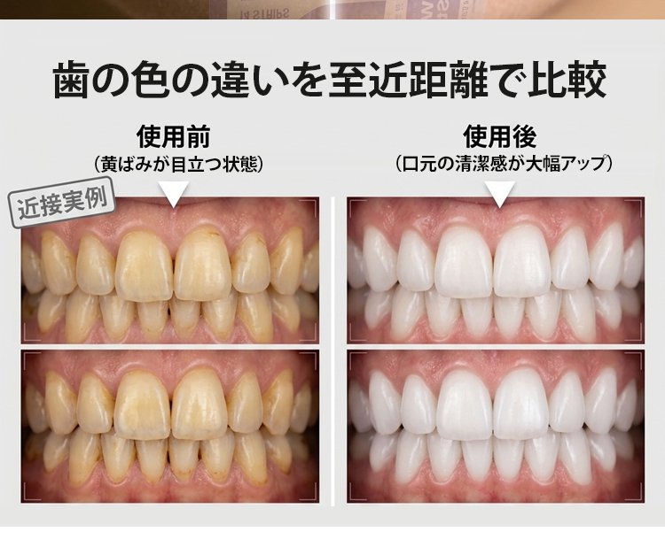 牙齿美白_13.jpg