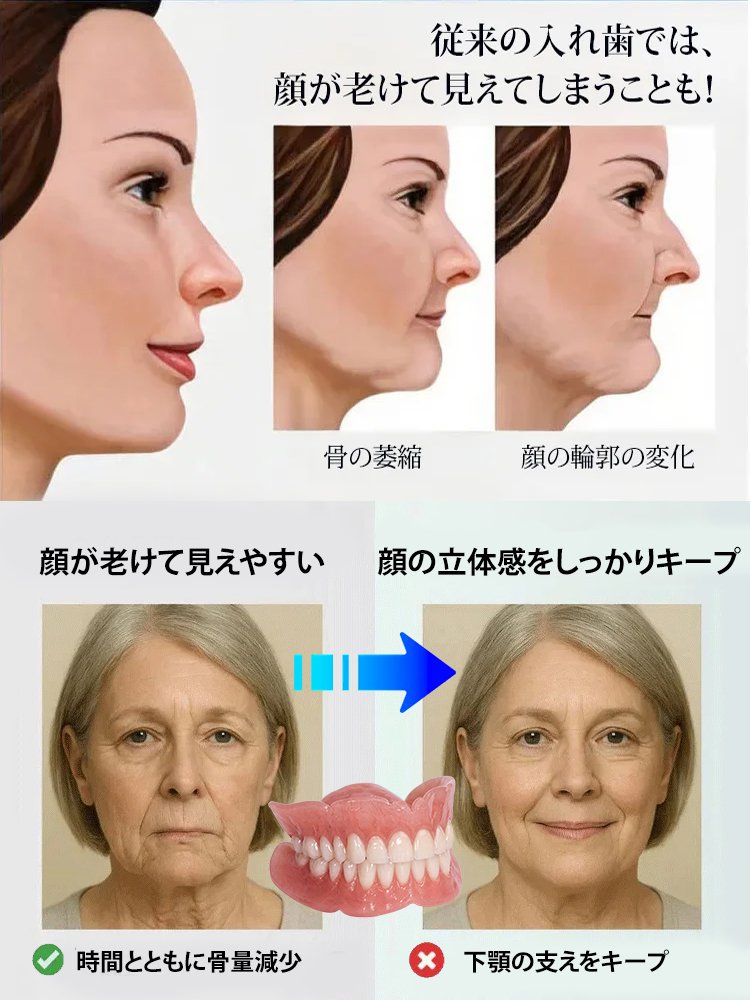 審美用マウスピース，スイス輸入品、口いっぱいのスイス製、そして高貴な身分の象徴！！