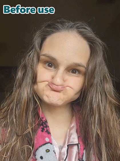 【Certificación FDA】Prótesis dentales personalizadas de ajuste perfecto