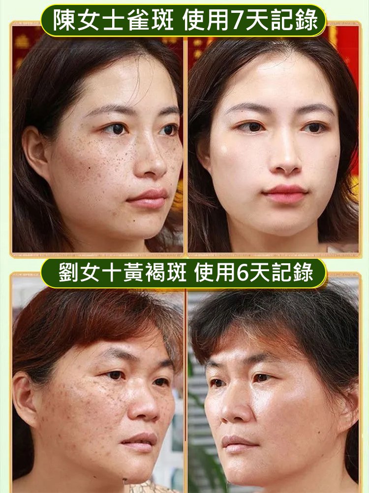 抗皺提拉淡紋淡斑緊緻抗老精華液