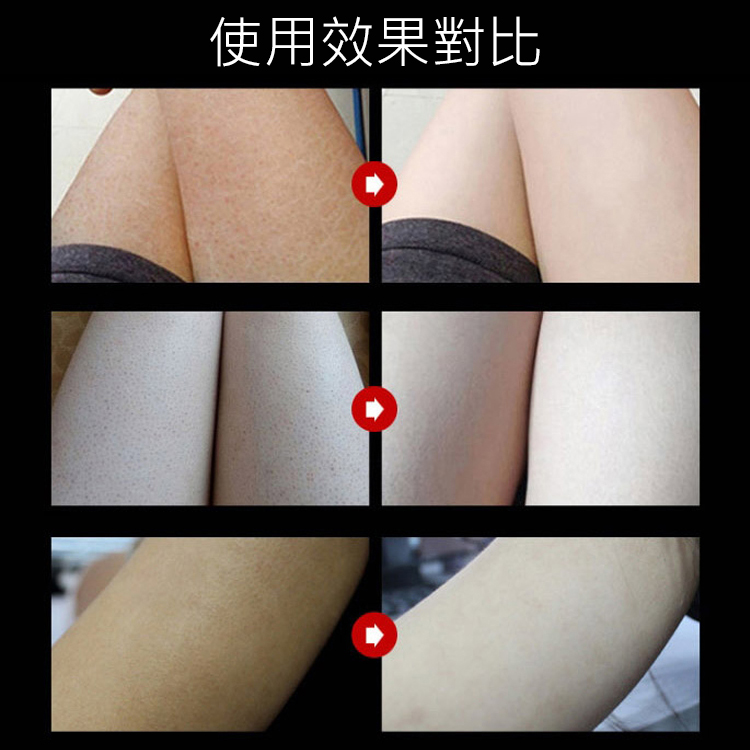 火爆全網的搓“泥”神器，1秒洗掉老廢角質、雞皮、痘痘，嫩過嬰兒肌！