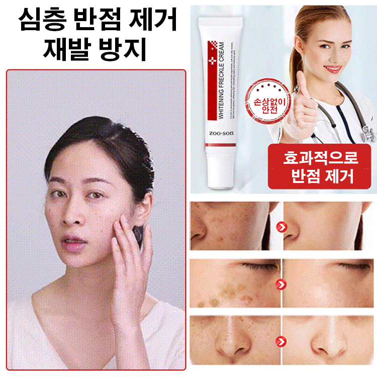 반점 제거 연고