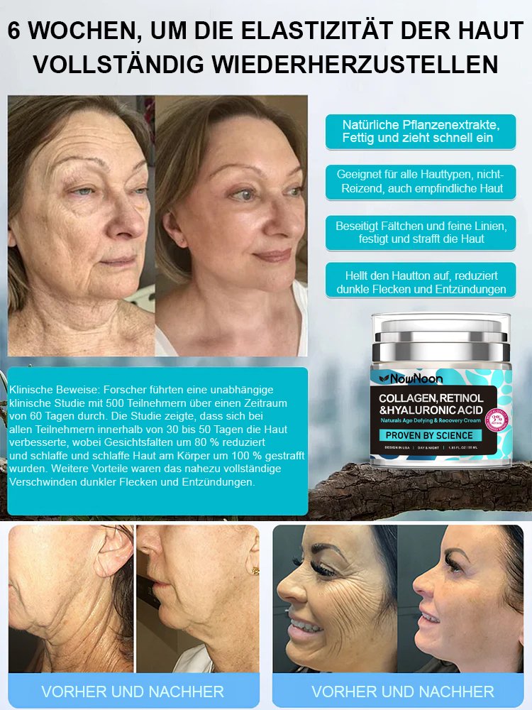 [Monatsverkauf 50.000 Stück] Kollagen-Retinol-Anti-Aging-Creme