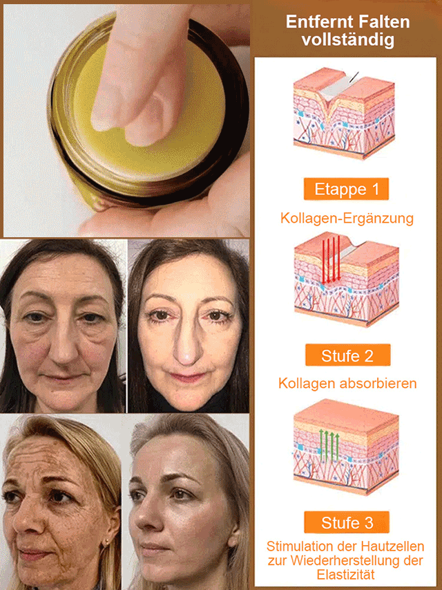 Bienengift Hautnarben glättende Creme