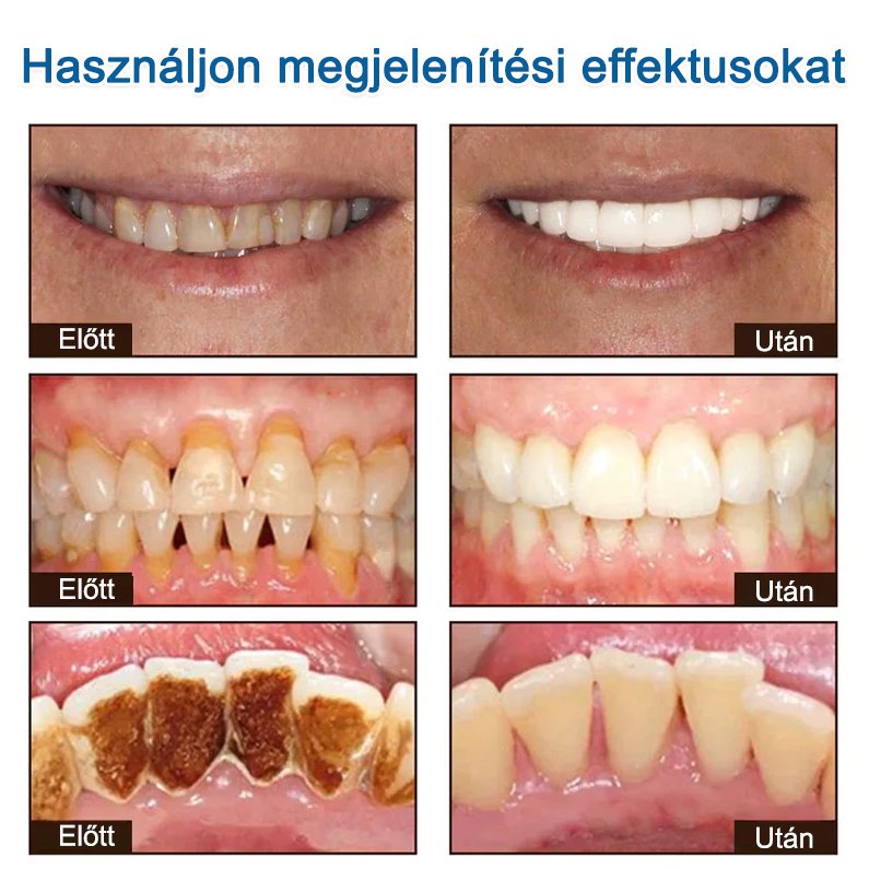 Jaysuing fehérítő fogkrém