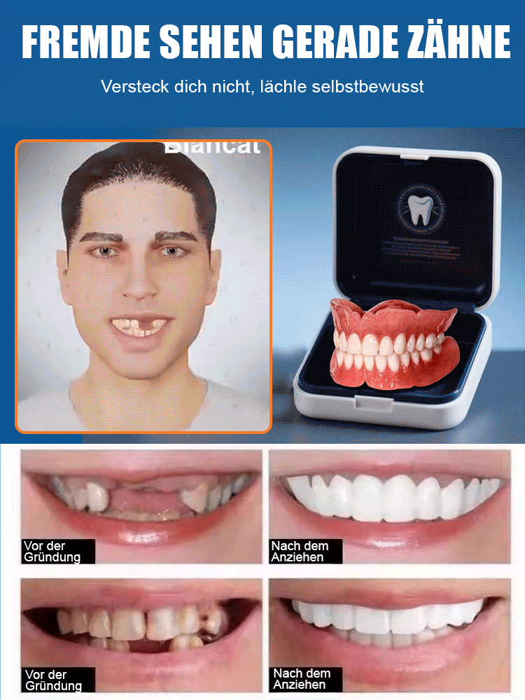 [Neue britische Forschungsergebnisse] Silikon-Simulationszahnspangen