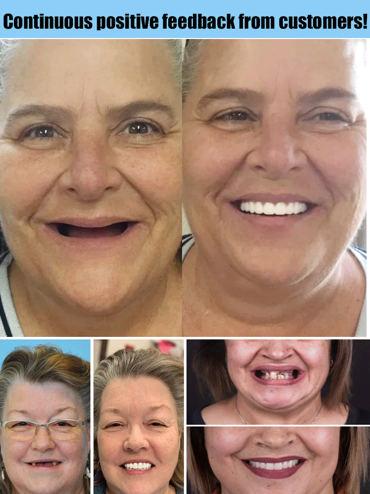 【Made in USA】Custom Full Mouth Dentures Kit