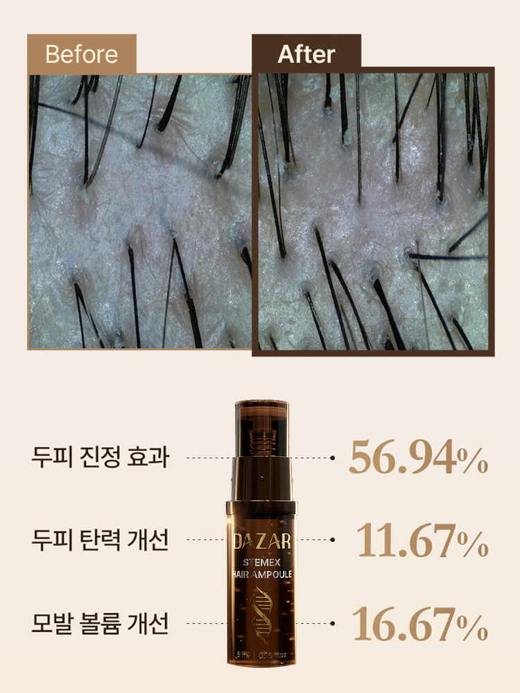 MTS 탈모 방지 헤어 앰플