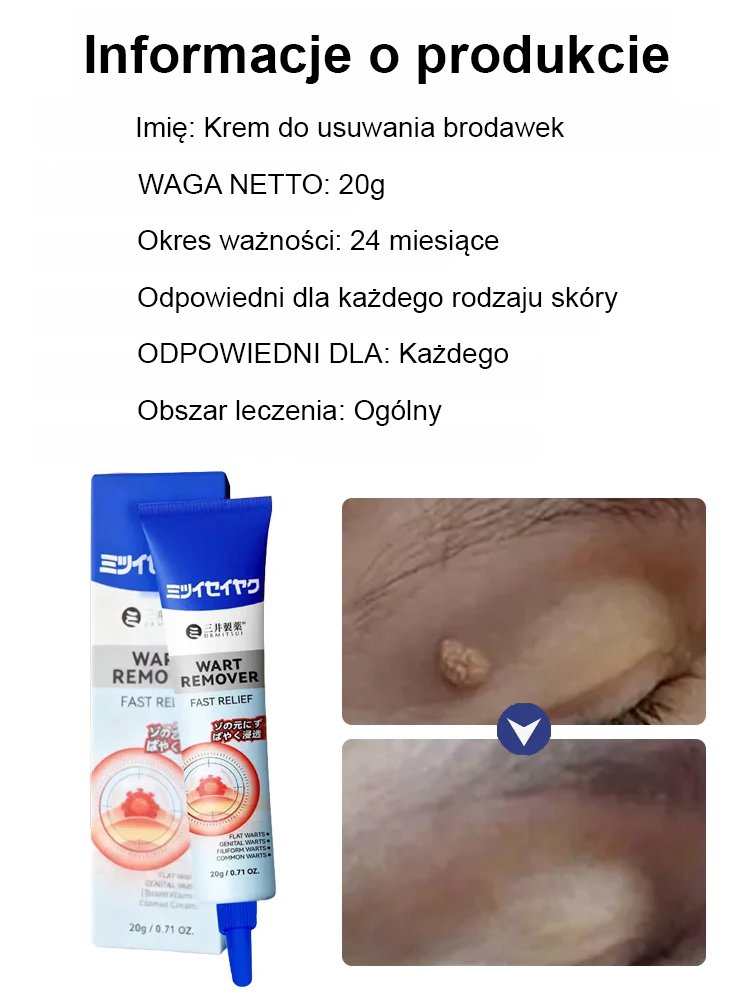 【Trzy sekundy na usunięcie brodawek】Japońska maść Mitsui Pharmaceutical na brodawki