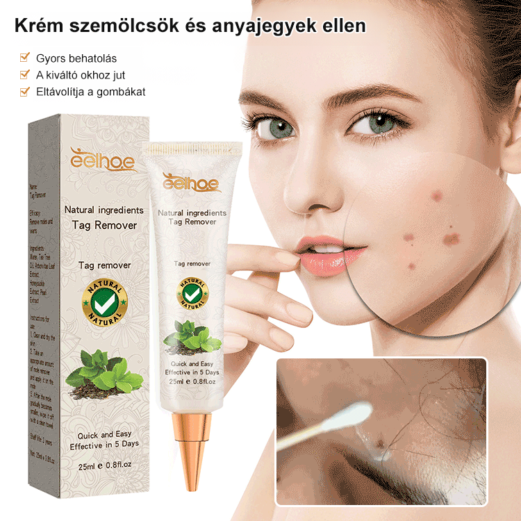 Eelhoe szemölcseltávolító kenőcs