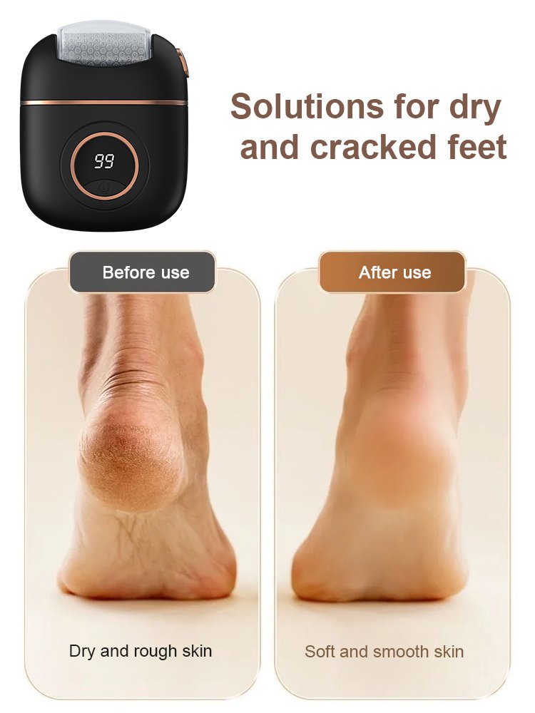 [Remove dead skin in seconds] Electric digital display foot grinder