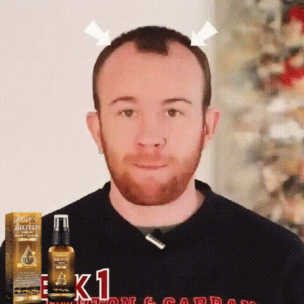 Spray para el crecimiento del cabello con biotina EELHOE