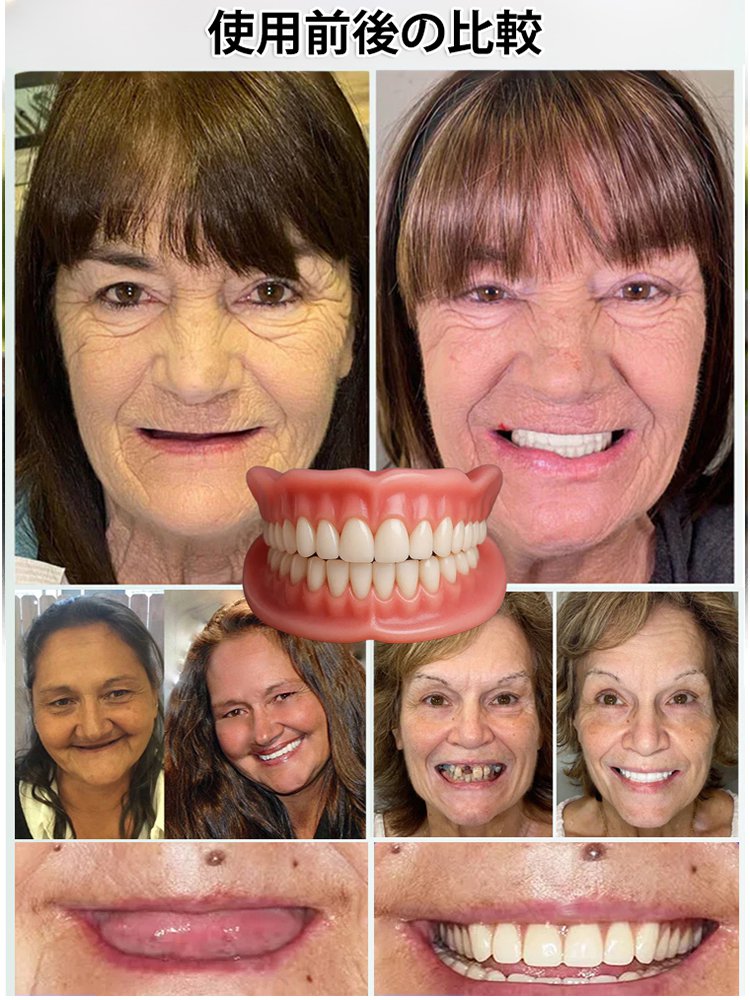 トータルケア対応の3-in-1ホワイトニング＆義歯美容キット