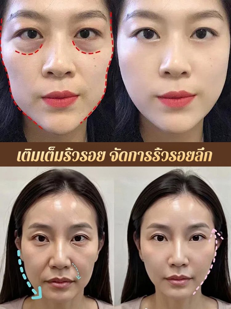 ครีมนมแพะบำรุงผิวลดริ้วรอย