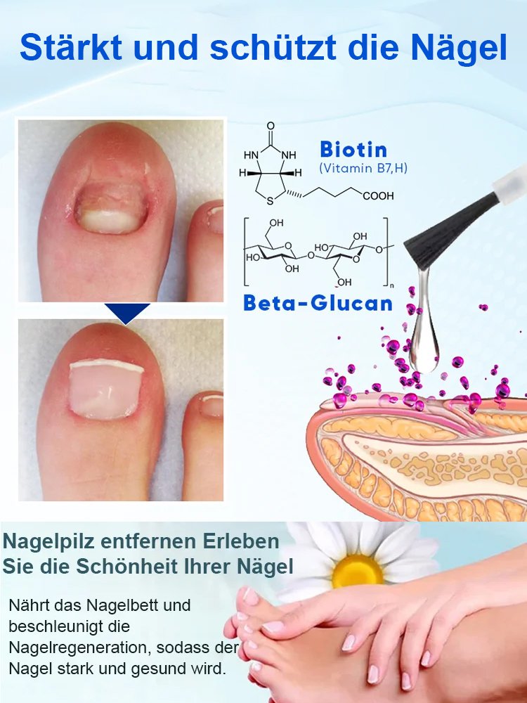 [Zurück zu Ihren gesunden Nägeln] Nail Repair Care Essence