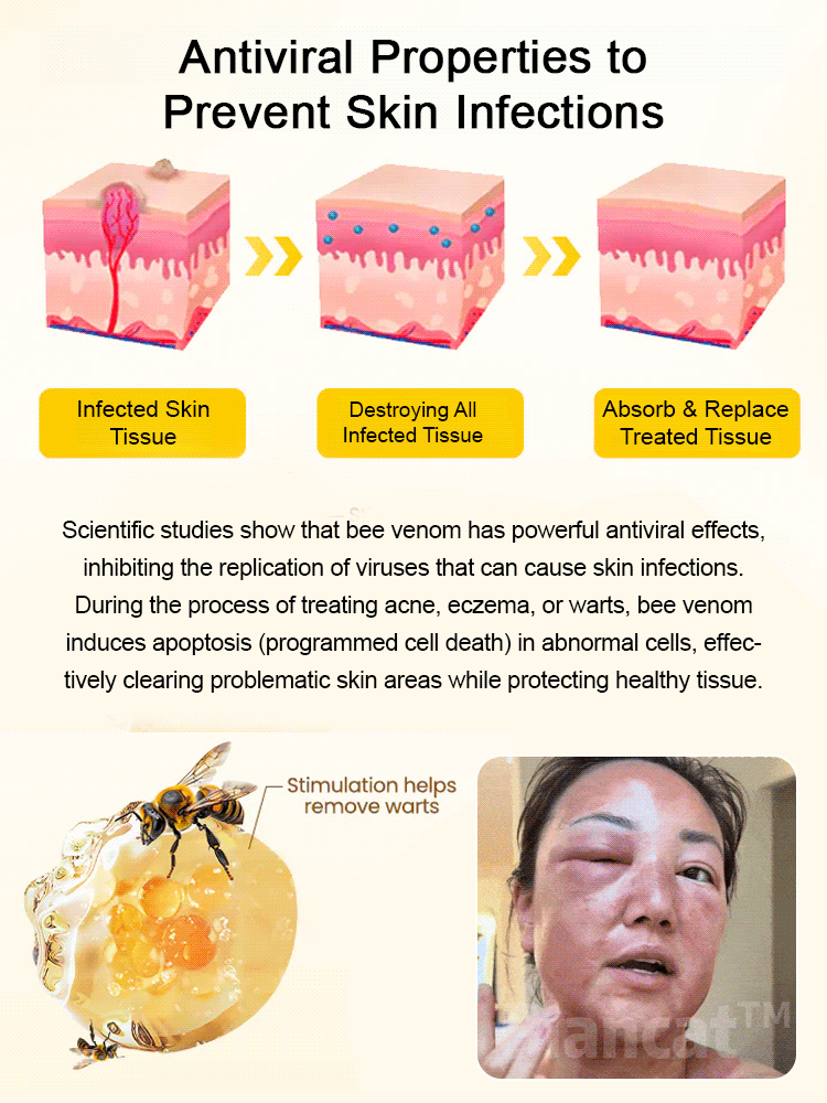 Bee venom skincare cream