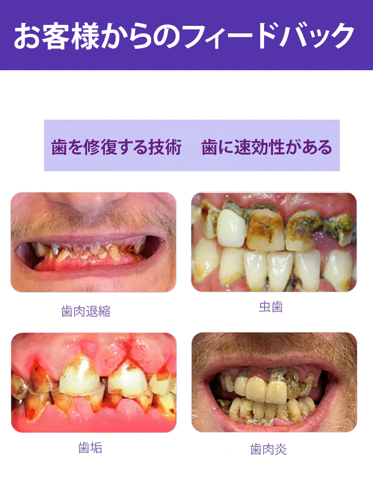 歯の修復ミネラルパウダー