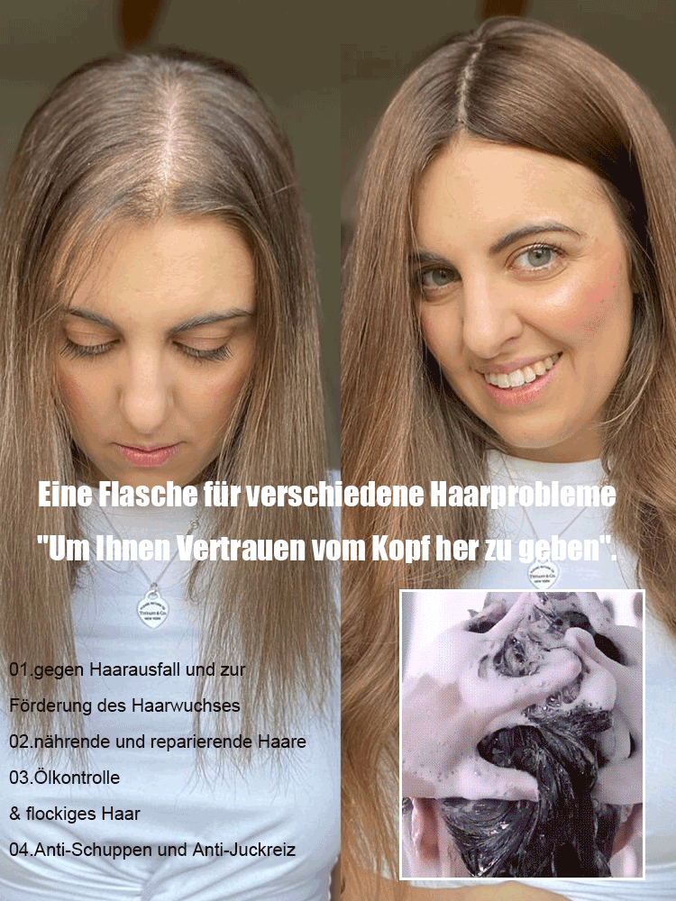 1 kaufen, 1 bekommen  Explosive Ginger Phytochemical Hair Loss Control Shampoo