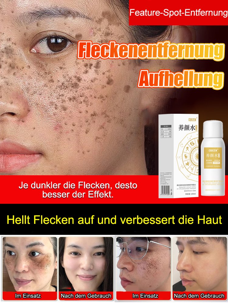 【Verschiedene Flecken - Ein Sprühstoß entfernt alles】Aufhellendes Anti-Flecken-Spray