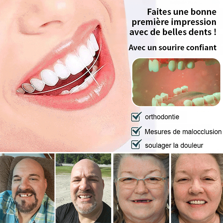 Ensemble de retouche dentaire oralhoe (colle d'alimentation)