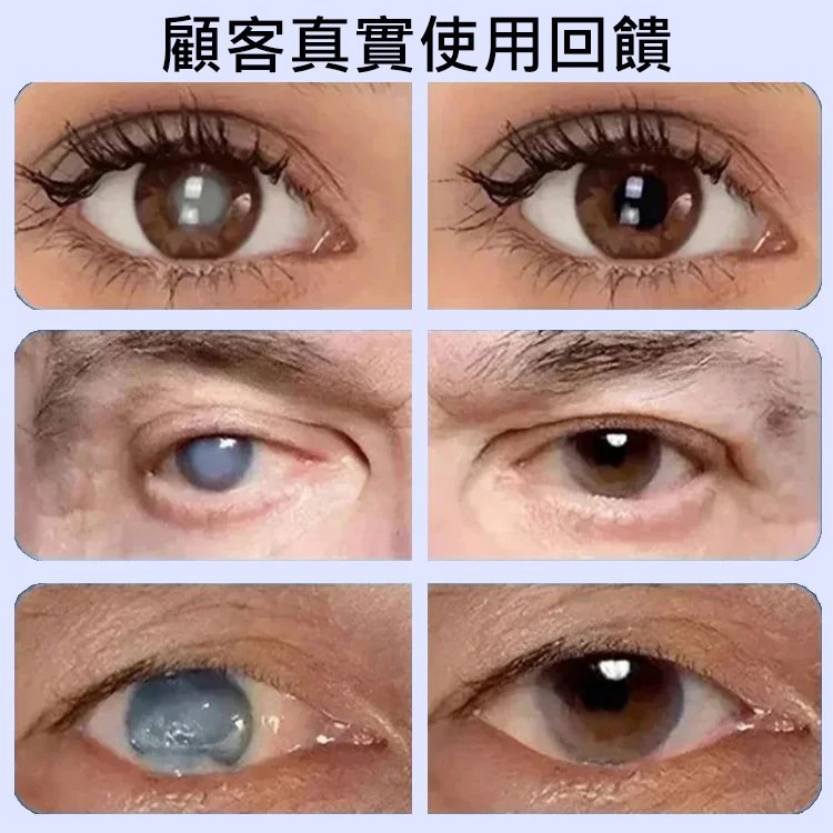 葉黃素花青素眼貼