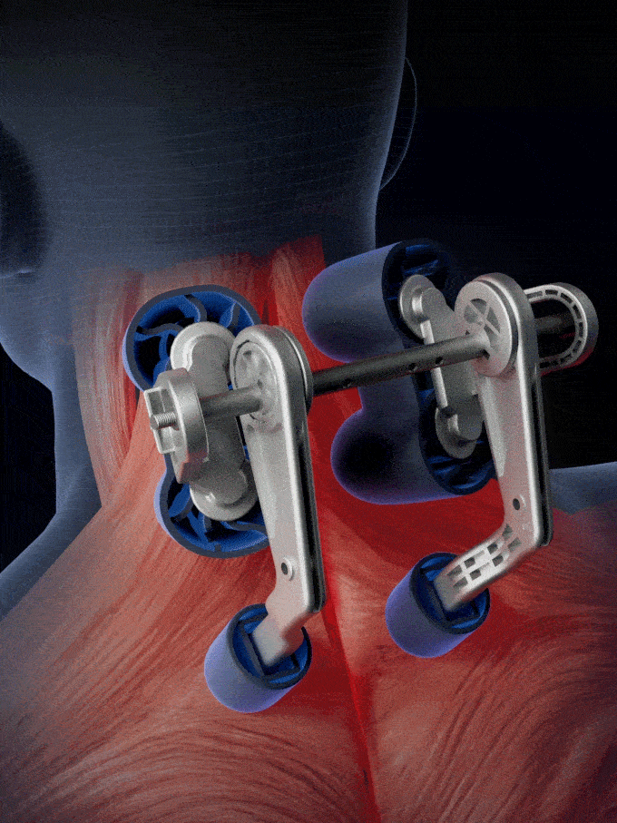 Cervical Clip Kneading Hot Compress Electric Massager