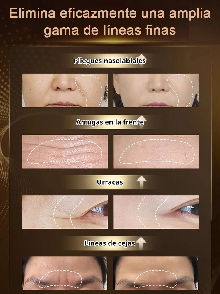 Leche concentrada antiarrugas bose