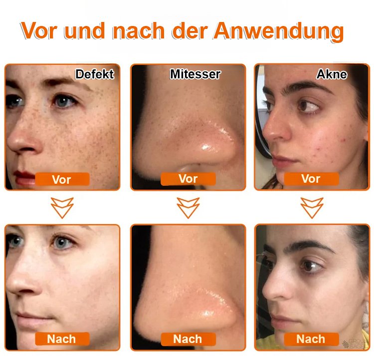 【Tiefenreinigung ohne Reizung】Geeignet für empfindliche Haut - Aufhellende Peel-Off-Maske