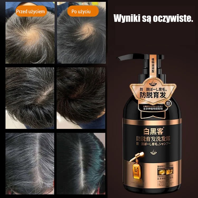 Szampon przeciw wypadaniu włosów i siwieniu "Od białego do czarnego